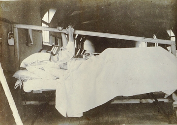 Photographie noir et blanc montrant un blessé de profil, allongé dans un lit d'hôpital et s'accrochant à une poutre en bois suspendue au-dessus de lui.